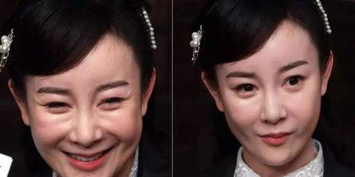 《整容》在线观看  第2张