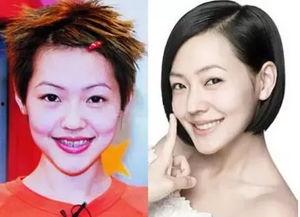 《整容》在线观看  第3张